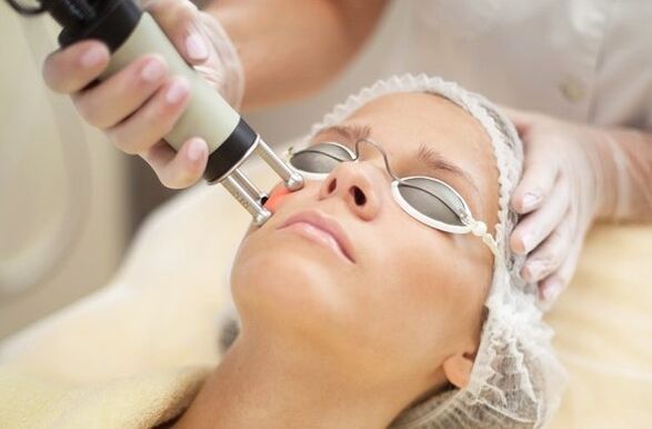 Exposure to heat with the epidermis