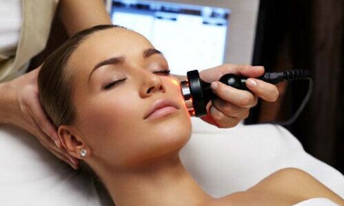 Laser rejuvenation of the face